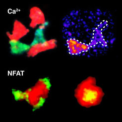 Using a calcium sensor shows that the calcium concentration in T cells (green) changes when it interacts with dendritic cells (red) [top]. The activation of the T cell (red) can be illustrated by the migration of the NFAT signal protein (green) from the cell plasma to the cell nucleus [bottom].