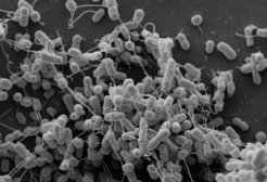 <p>Elektronenmikroskopische Aufnahme gentechnisch ver&auml;nderter Bakterienst&auml;mme der Arten <em>Escherichia coli</em> und <em>Acinetobacter baylyi</em>, die Aminos&auml;uren &uuml;ber Nanokan&auml;le (schlauch&auml;hnliche Verbindungen zwischen Zellen) austauschen.</p>