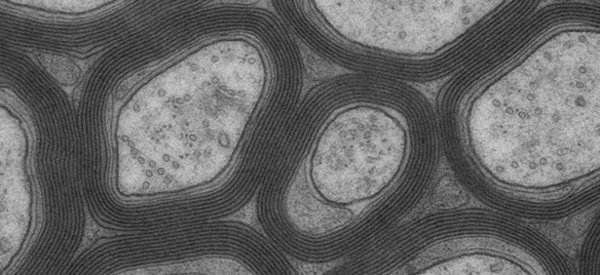 Querschnitt durch Nervenzellfortsätze (Axone) des Sehnervs. Die Axone sind von speziellen Gliazellen umgeben, den Oligodendrozyten, die sich in mehreren Lagen um die Axone wickeln. Zwischen den Axonen befinden sich Fortsätze von Astrozyten, einer wei