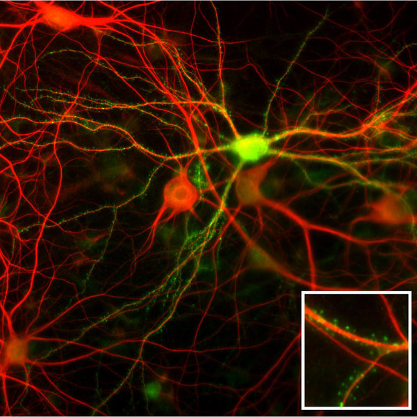 When nerve cells can¿t make contact | Max-Planck-Gesellschaft