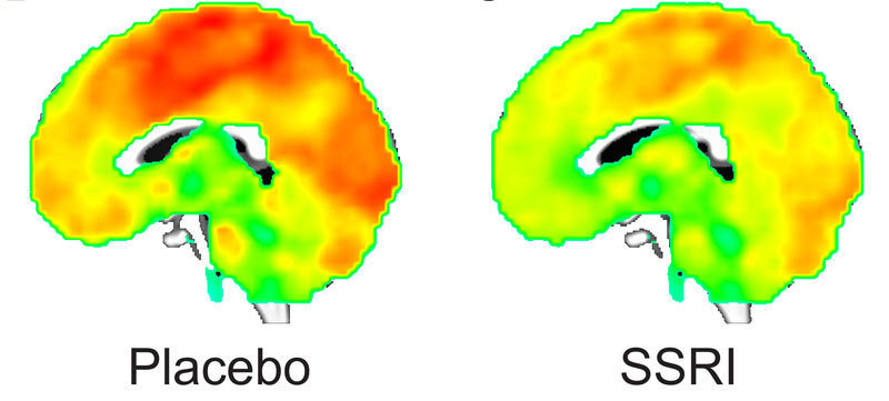 Escitalopram alters functional brain architecture in a matter of hours