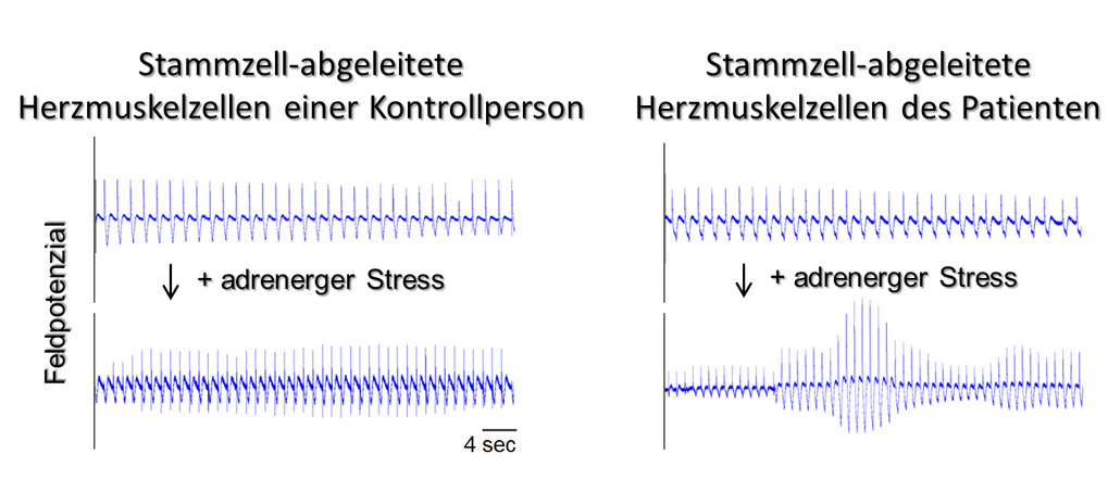 Herzmuskelgewebe Aus Pluripotenten Stammzellen Wie Das Geht Und Wozu Es Zu Gebrauchen Ist Max Planck Institut Fur Molekulare Biomedizin