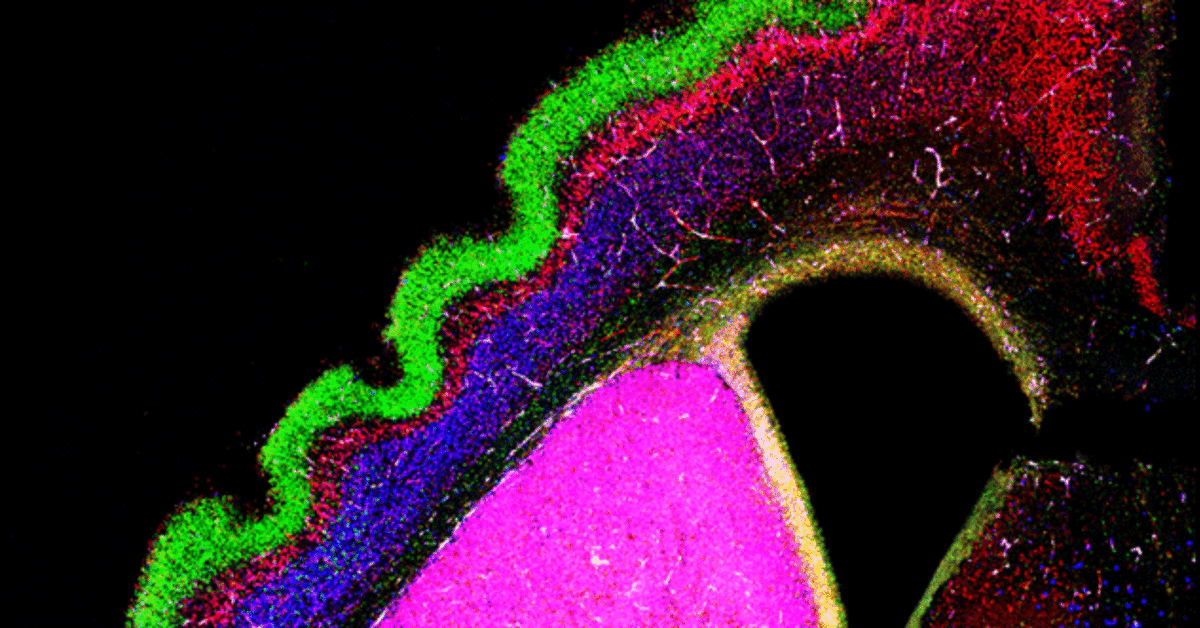 The formation of folds on the surface of the brain