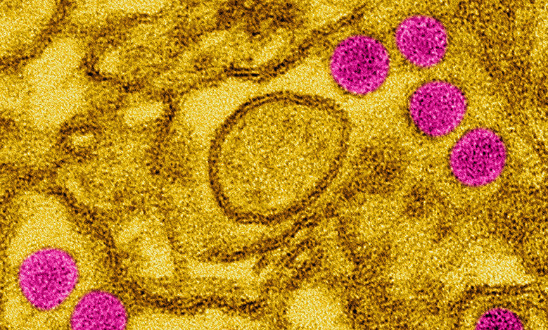 Zika Virus Successfully Produced In The Laboratory Max Planck Gesellschaft 5364