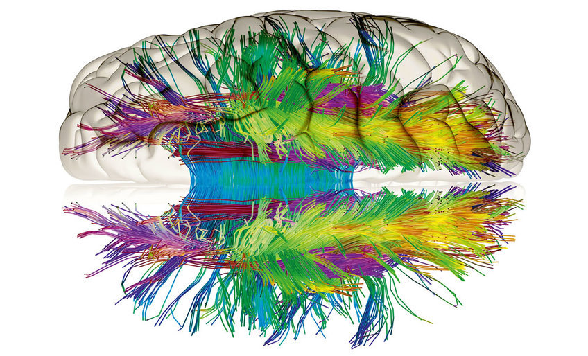 Full shot of a 3D representation of a human brain's white matter fiber tracts. The brain is presented in a semi-transparent, light gray tone, and the fiber tracts are depicted in a variety of colors, creating a vibrant and complex visualization. The colors are not uniformly distributed; different colors likely represent different pathways or connections between various brain regions. The representation gives a sense of depth, with the fiber tracts appearing to originate from different points within the brain and extend outward in a radiating pattern. The fiber tracts appear as thin lines or filaments, appearing dense in areas and sparsely in others, with some tracts crossing others. A reflection of the brain is visible below the main image, mirroring the pattern and color scheme of the fiber tracts. This visual effect reinforces the 3D nature of the depiction. The background is a plain white color.