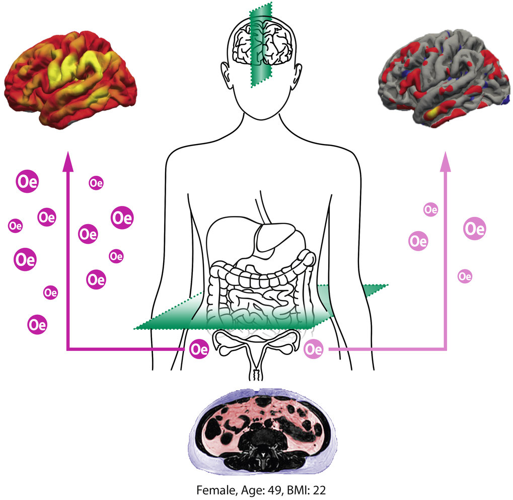 Sexual hormone oestradiol protects female brain in mid-life |  Max-Planck-Gesellschaft