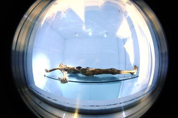 Ötzi: dark skin, bald head, Anatolian ancestry