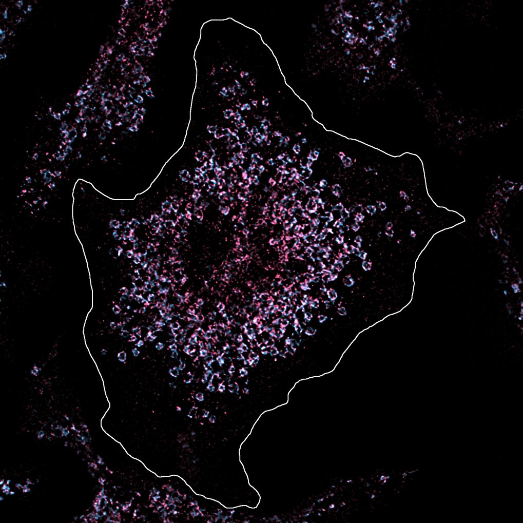 Descubrimiento de un desencadenante del lupus hereditario