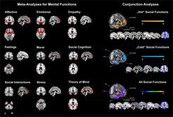 Die Metaanalyse der Forscher zeigt mithilfe von Big Data, welche Gehirnregionen mit unterschiedlichen Gefühlen verbunden sind.