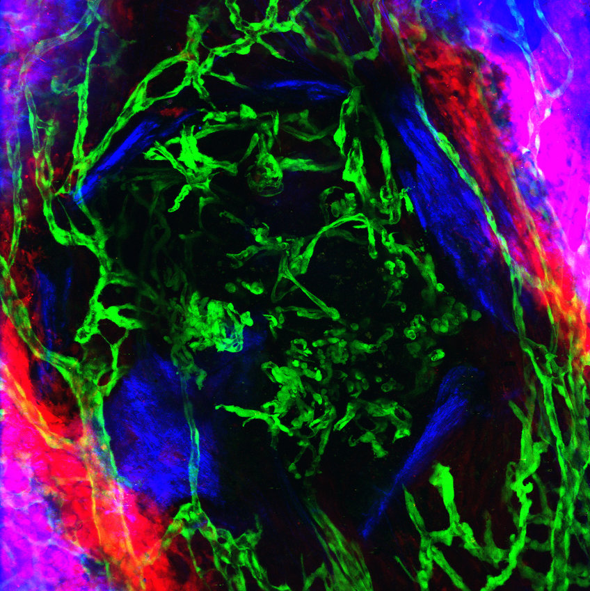 Blood vessels (green) have completely vascularized the bone injury (blue), while bone cells (red) are just beginning to form new bone.