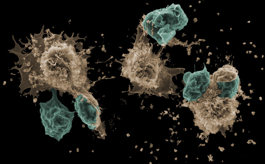 This scanning electron microscopy image captures the moment where degranulating mast cells (sepia) attract and start to incorporate living neutrophils (cyan), forming cell-in-cell structures where mast cells trap living neutrophils inside them.  