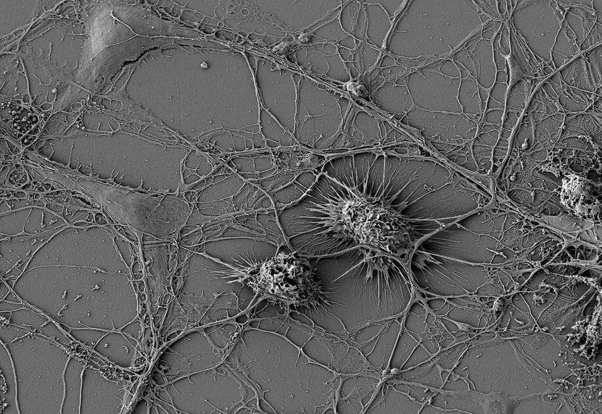 Electron microscope image of brain cells
