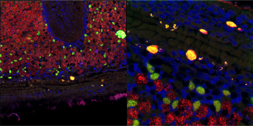 Microscopy image of tissues from a deep-sea mussel showing the intranuclear parasite Candidatus Endonucleobacter in yellow, and the beneficial symbiotic bacteria in green and red. Cell nuclei are stained blue. The right panel is a zoom-in of the white square in the left panel. 