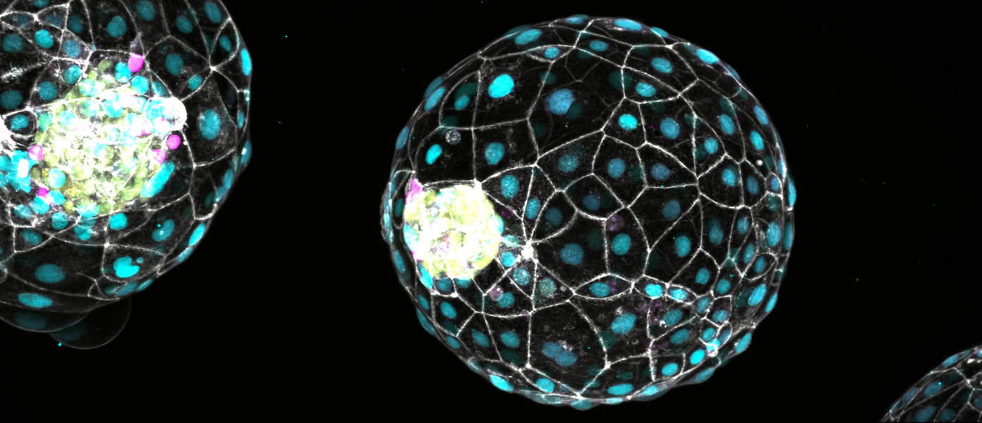 Measurements by the Copernicus satellite Sentinel-5P in 2023 show the ozone hole over the Antarctic.