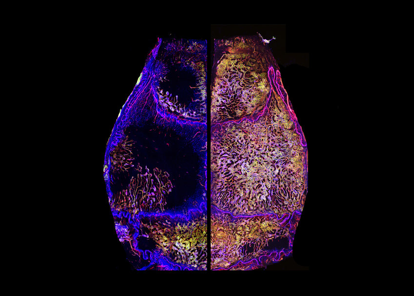 Skull bone marrow vessels (red) of a young adult (left) and a geriatric (right) mouse.