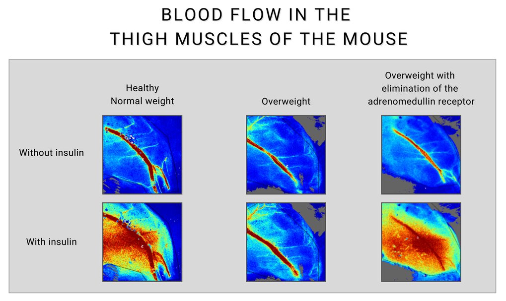 In healthy, normal-weight mice, insulin increases blood flow to the muscles by activating its receptor on the inside of the blood vessels (the endothelium) (shown in red, left). As a result, insulin and glucose reach the muscle cells efficiently, and insulin promotes the uptake of glucose into the muscle cells. This leads to a reduction in blood glucose levels. In overweight diabetic mice (middle pictures), there is considerable insulin resistance in the vascular system, which means that insulin has little effect on blood flow to the muscles. This insulin resistance in the vasculature is caused by increased levels of adrenomedullin. If the adrenomedullin receptor is switched off in overweight diabetic animals (right), adrenomedullin loses its effect and insulin resistance decreases significantly. Insulin can now, as in a healthy state, cause a significant increase in muscle perfusion, leading to an improved metabolic state with reduced blood glucose levels.