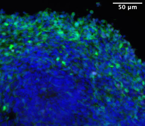 A brain organoid after exposure, showing an abundance of inhibitory neurons (in green).