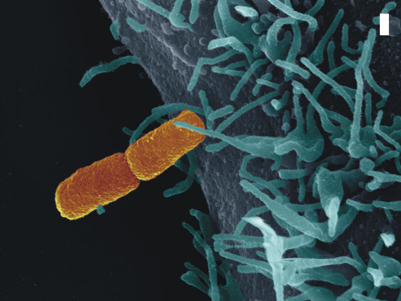 Shigella Flexneri